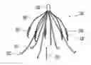 Fig. 01 - Inferior vena cava filter with stability features