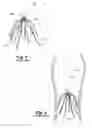 Fig. 02 - Inferior vena cava filter with stability features