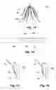Fig. 07 - Inferior vena cava filter with stability features