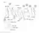 Fig. 13 - Device for tendon and ligament reconstruction