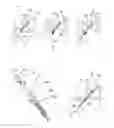 Fig. 16 - Device for tendon and ligament reconstruction