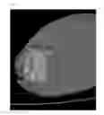 Fig. 18 - Device for tendon and ligament reconstruction