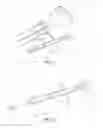 Fig. 02 - Implantation of micronized allograft tissue over a microfractured defect