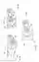Fig. 06 - Expandable intervertebral fusion device