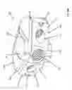 Fig. 45 - Expandable intervertebral fusion device