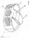 Fig. 46 - Expandable intervertebral fusion device
