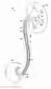 Fig. 01 - Linearly expandable ureteral stent
