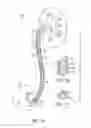 Fig. 02 - Linearly expandable ureteral stent