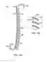 Fig. 04 - Linearly expandable ureteral stent