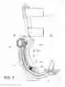 Fig. 08 - Ankle orthosis