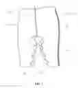 Fig. 02 - FIXATION DEVICE FOR PELVIS