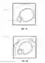 Fig. 02 - Syndesmosis reduction device and method of use