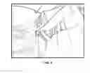 Fig. 09 - Syndesmosis reduction device and method of use