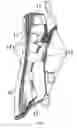 Fig. 02 - EXTERNAL FIXATION DEVICE FOR ORTHOPEDICS OF FOREARM AND PALM