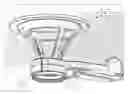 Fig. 01 - Medication-coated patient interface device for ophthalmic laser surgery