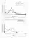 Fig. 08 - Antipsychotic Injectable Depot Composition