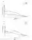 Fig. 12 - Antipsychotic Injectable Depot Composition