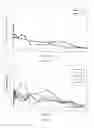 Fig. 13 - Antipsychotic Injectable Depot Composition