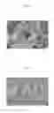 Fig. 02 - Active agent loaded uniform, rigid, spherical, nanoporous calcium phosphate particles and methods of making and using the same