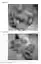 Fig. 02 - Compositions and methods for treating and preventing adhesions and ileus