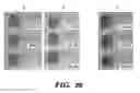 Fig. 35 - Methods for treatment of melanoma