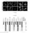 Fig. 03 - Compositions And Methods To Treat And/Or Prevent Vision Disorders Of The Lens Of The Eye