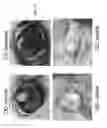 Fig. 07 - Compositions And Methods To Treat And/Or Prevent Vision Disorders Of The Lens Of The Eye