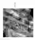 Fig. 09 - Compositions And Methods To Treat And/Or Prevent Vision Disorders Of The Lens Of The Eye