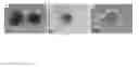 Fig. 09 - Therapeutic use of electroacupuncture-induced mesenchymal stem cells