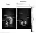 Fig. 01 - PET-imaging immunomodulators