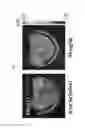 Fig. 02 - PET-imaging immunomodulators