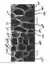 Fig. 09 - IMPLANTABLE EMBOLIC SCAFFOLDS