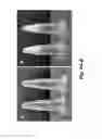 Fig. 05 - Method to enhance wound healing using silk-derived protein