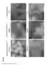 Fig. 09 - MATRIX BOUND NANOVESICLES AND THEIR USE