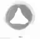 Fig. 03 - METHOD OF PROCESSING BIOLOGICAL TISSUE