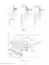 Fig. 02 - Apparatus and method for the treatment of defects internal of the body