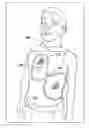 Fig. 01 - Universal defibrillation electrode pad assembly for adult and pediatric subjects