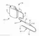 Fig. 01 - Medical device lead connection assembly