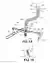 Fig. 02 - Bracket for installation of a fire protection sprinkler
