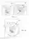 Fig. 09 - Method for laser welding steel workpieces