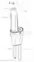 Fig. 02 - Surgical devices and methods for driving an implant and applying counter torque