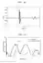 Fig. 08 - Inkjet head and inkjet printer
