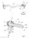 Fig. 02 - Axial ball joint and length-adjustable two-point link with such an axial ball joint