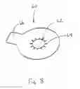 Fig. 09 - SHIPPING LOCK AND BOTTLE HANGER