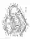Fig. 02 - Wire tensioner tip