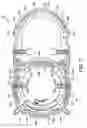 Fig. 04 - Wire tensioner tip