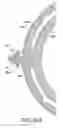 Fig. 35 - Wire tensioner tip