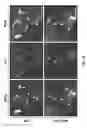Fig. 06 - Methods of treating mitochondrial disorders