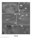 Fig. 07 - Methods of treating mitochondrial disorders