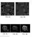 Fig. 04 - Plectin-1 binding antibodies and uses thereof